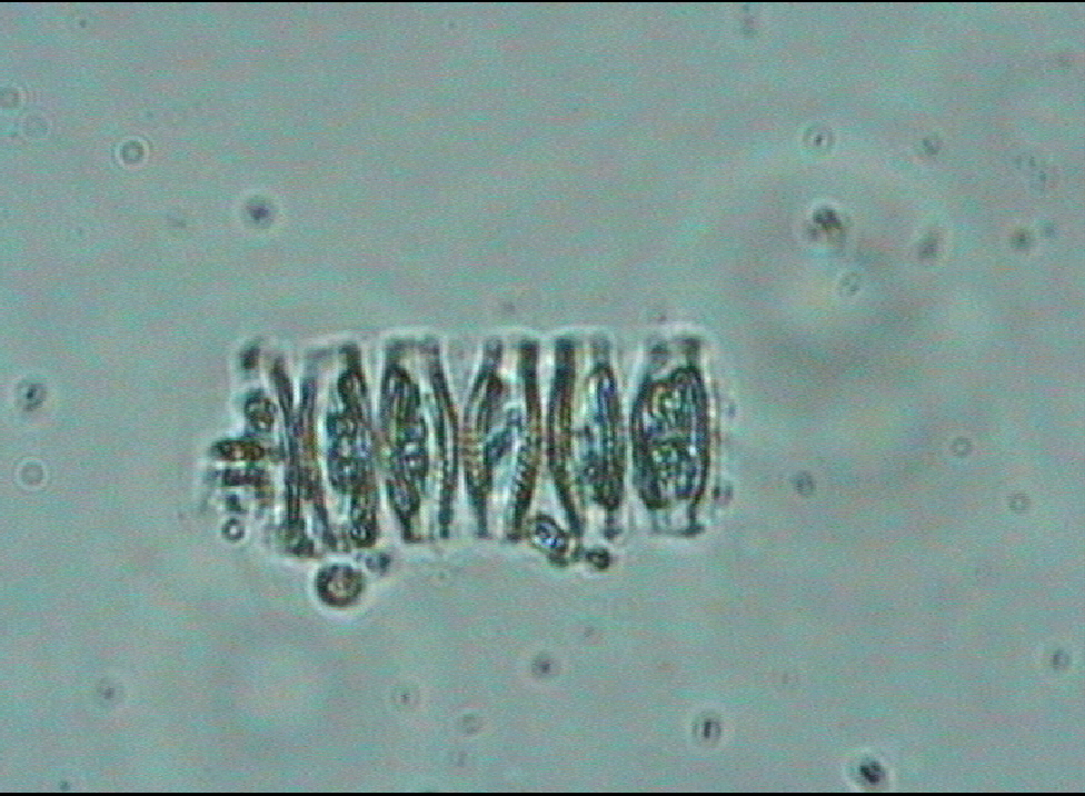 Dictyocha speculum